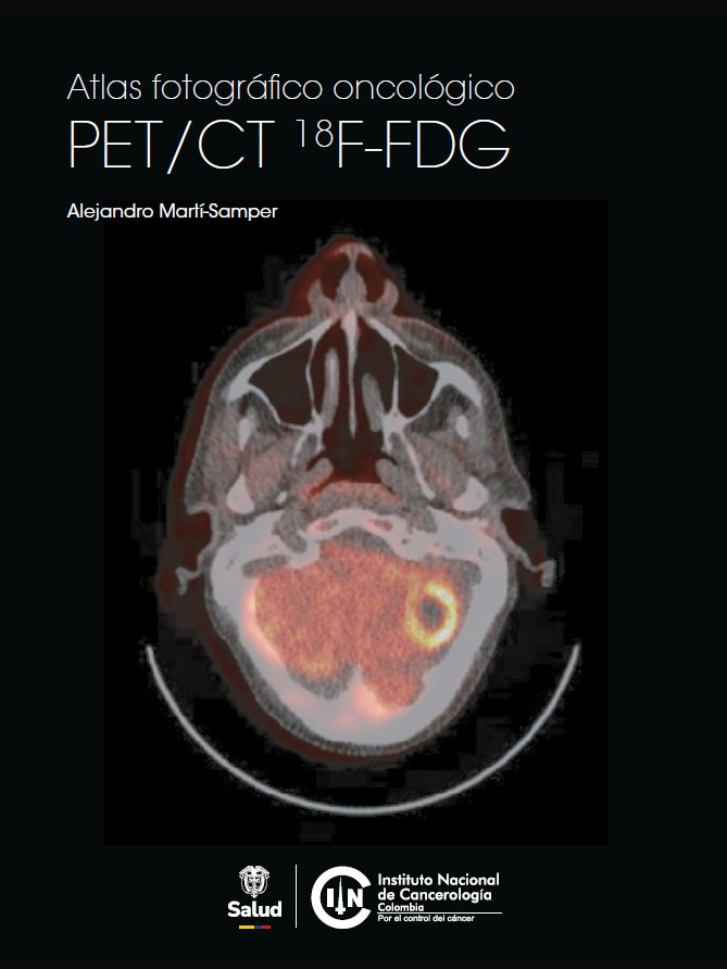 Atlas PET/CT 