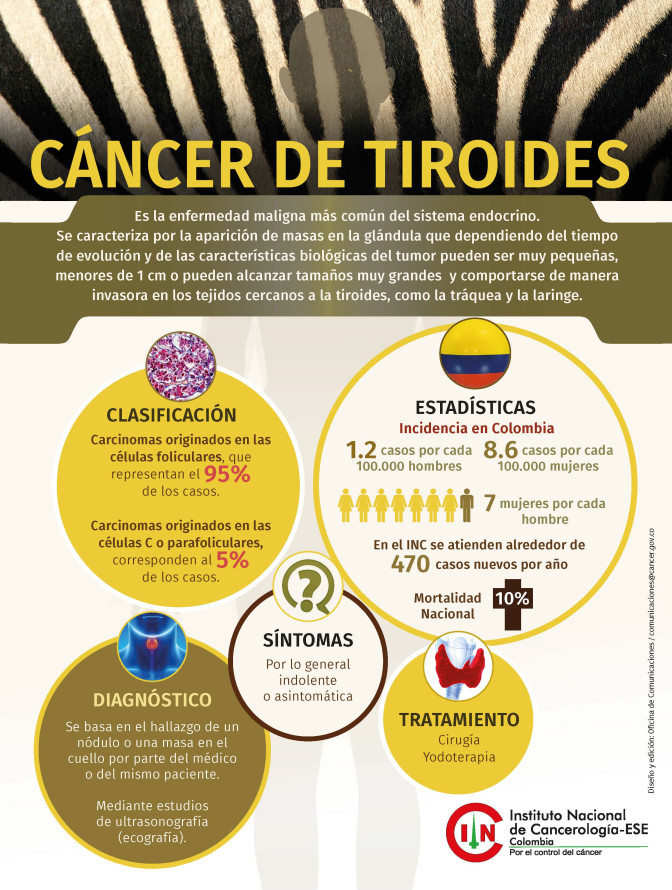 infografia-tiroides.jpg