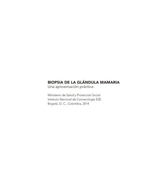 Biopsia de la glándula mamaria. Una aproximación práctica