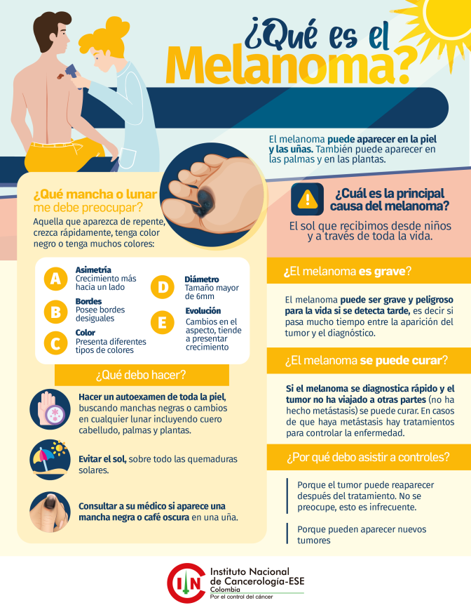 Melanoma
