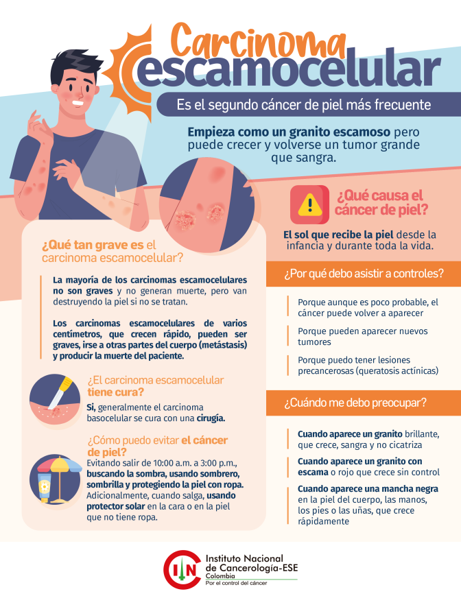Evite el carcinoma basobascular